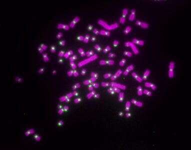 Chromosome spread from a cancer cell line (Image © Owen Marshall)