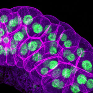 Salivary glands from a <i>Drosophila melanogaster</i> larva