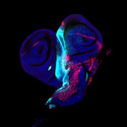 A heart in the wrong place (ectopic Adb-B expression in the wing disc)
