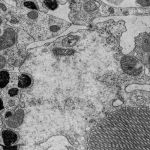 Electron microscopy of <i>Drosophila</i> retina exposed to insecticides