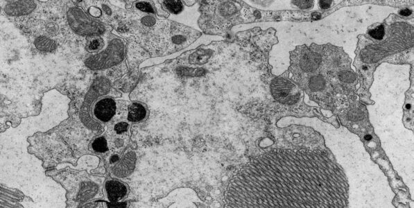 Electron microscopy of <i>Drosophila</i> retina exposed to insecticides