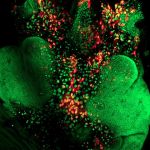 Thorax closure during metamorphosis in <i>Drosophila</i>