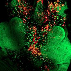 Thorax closure during metamorphosis in <i>Drosophila</i>