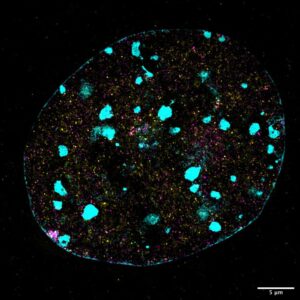 Nuclear Galaxy: Nucleus stained with DAPI and an
epigenetic modifier protein Smchd1, acquired using 3D structural illumination microscope.