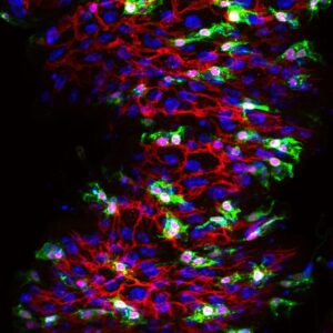Tornado: 10-day old wildtype adult <i>Drosophila melanogaster</i> midgut in the anterior region
