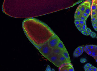 <i>Drosophila</i> ovary (Image © Anabel Herr)